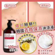 韓國製造Nard ACNE Clear Body Wash去痘保濕沖涼液500ml